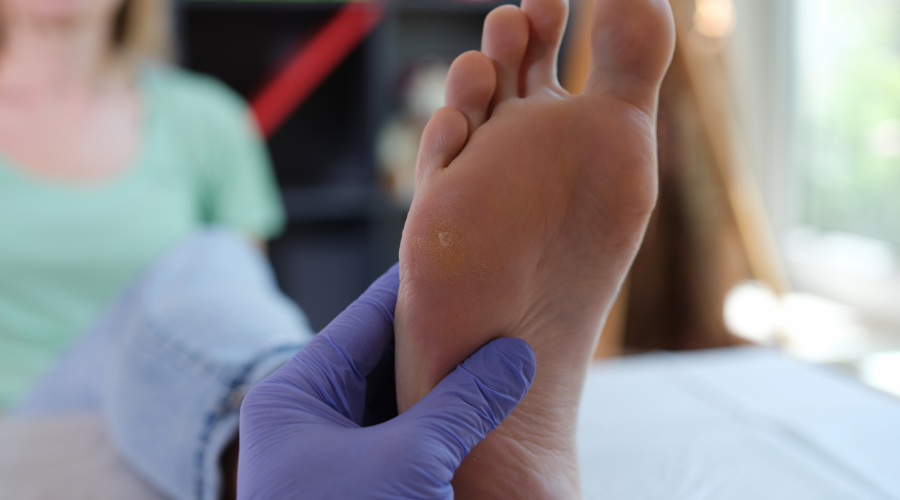 Avez-vous pensé à examiner la peau de vos pieds, avant l’été?